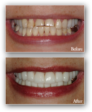 dr kavan patel s dental clinic designer dentistry and smiles